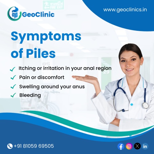 Symptoms-of-piles